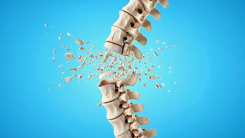 Study finds 14.6% of Indian men have osteoporosis, 50.3% have weak bones